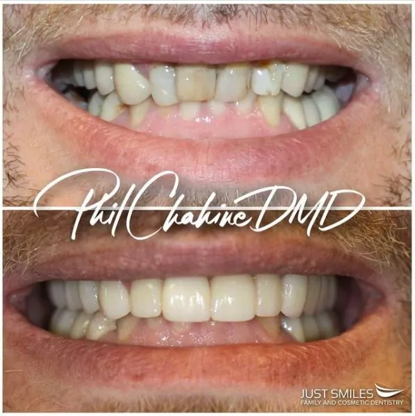 Cosmetic Dentistry - Westerville OH