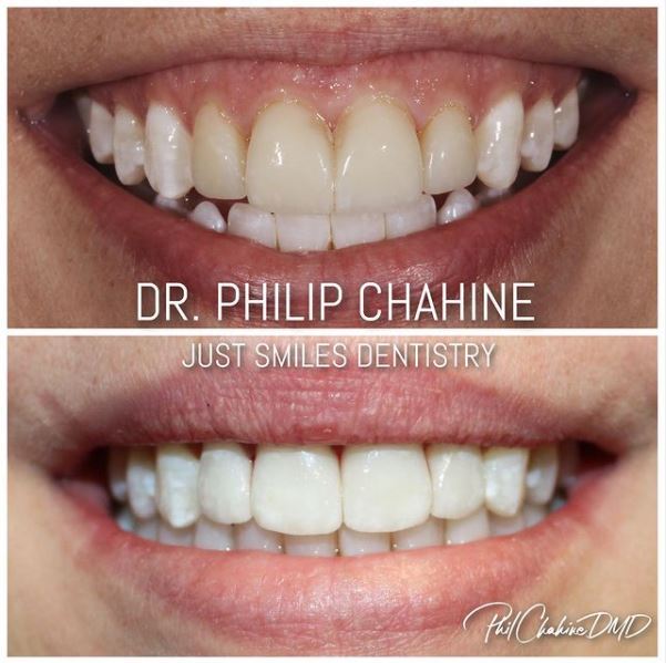 Results from Dr Phil Chahine in Hilliard OH