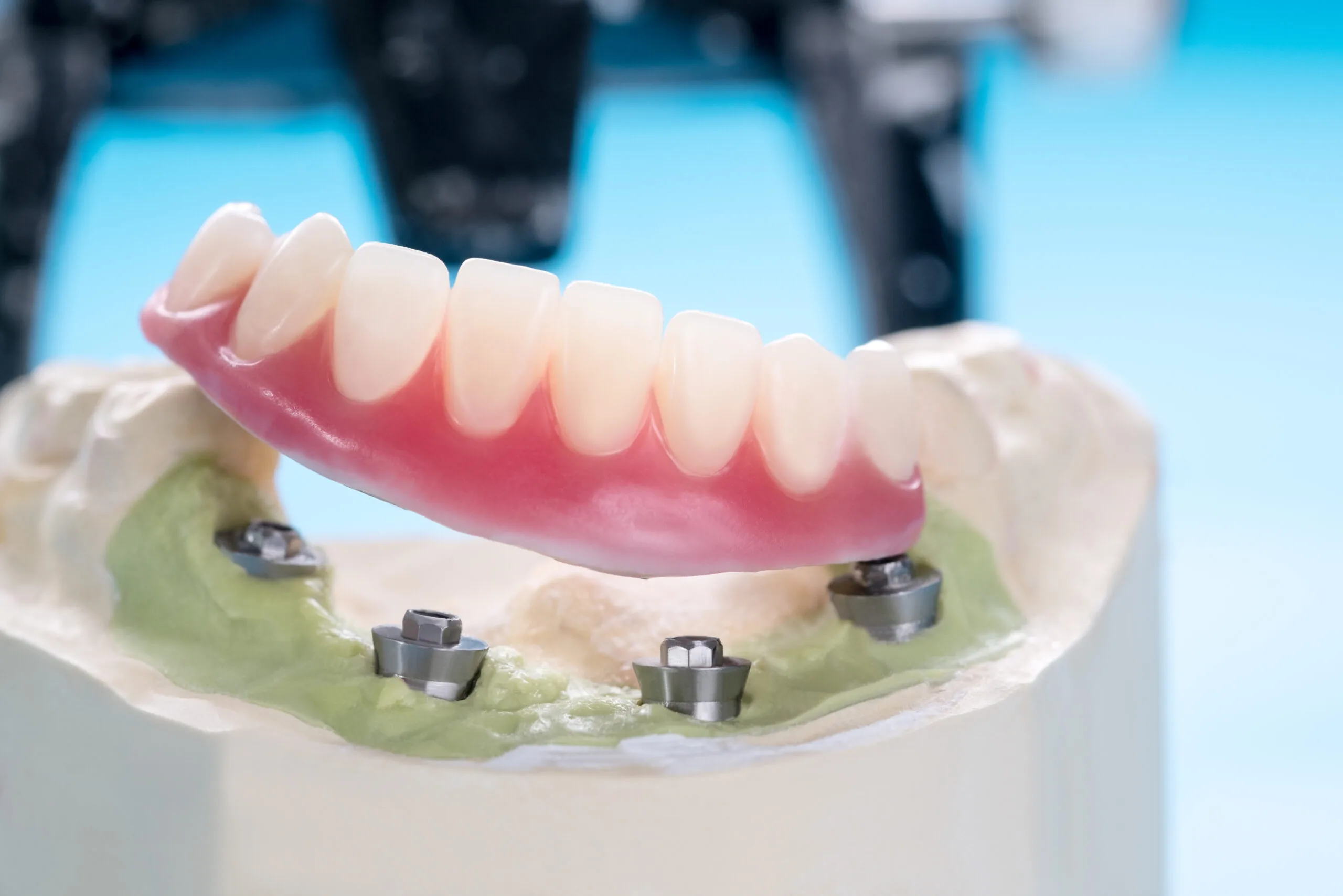 close up of a partial denture in Hilliard