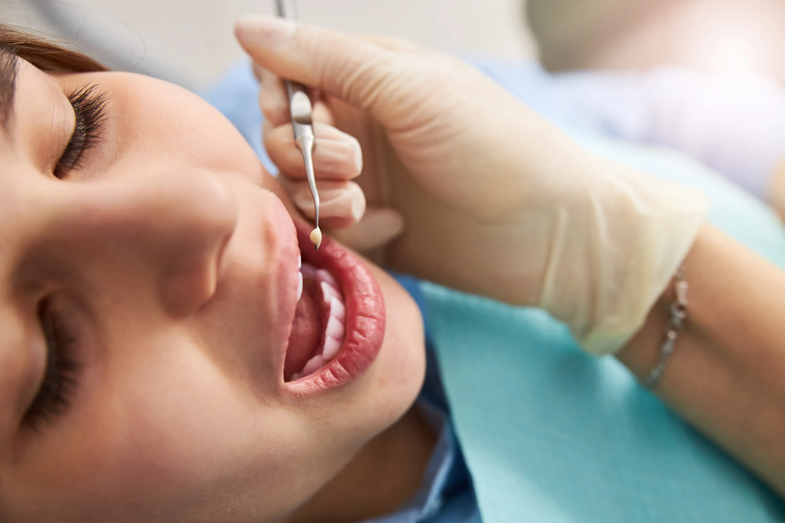 dentist checking a female patients tooth, need for root canal therapy