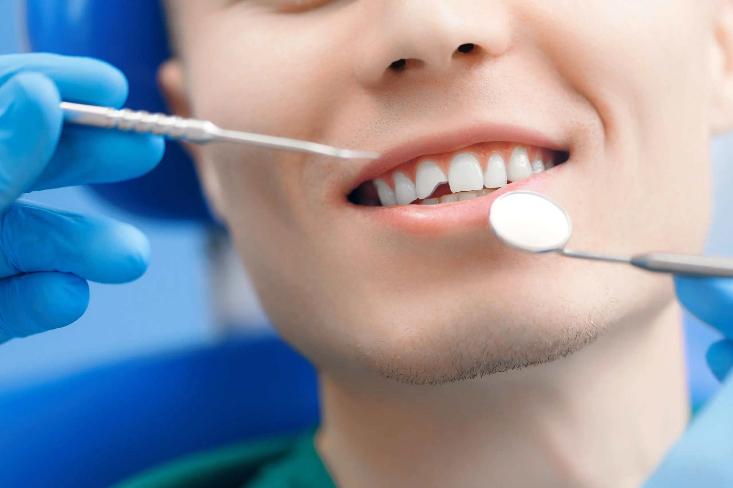 closeup of a dentist blue gloves assessing a chipped tooth